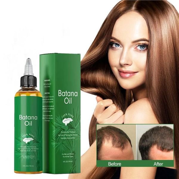 OEM Customized 118ml/bottle Organic Natural Promote Hair Growth Nourishing and Thickening Batana Oil for Men and Women Hair Care